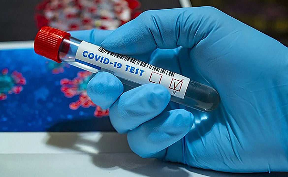 Рівень захворюваності на Covid-19